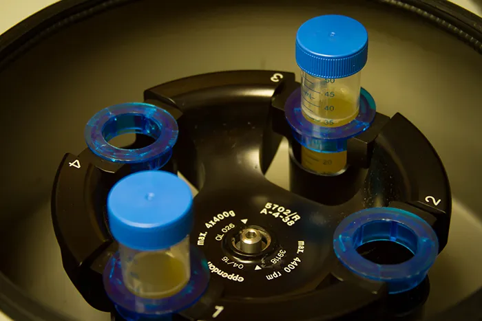 Centrifuge and stem cells